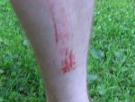 leg_001_356.jpg